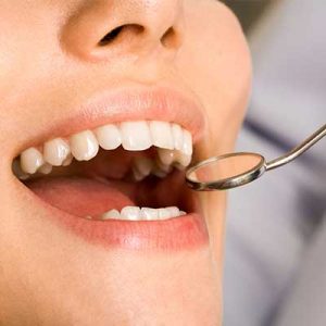 Tratamientos Adeslas Dental MAX